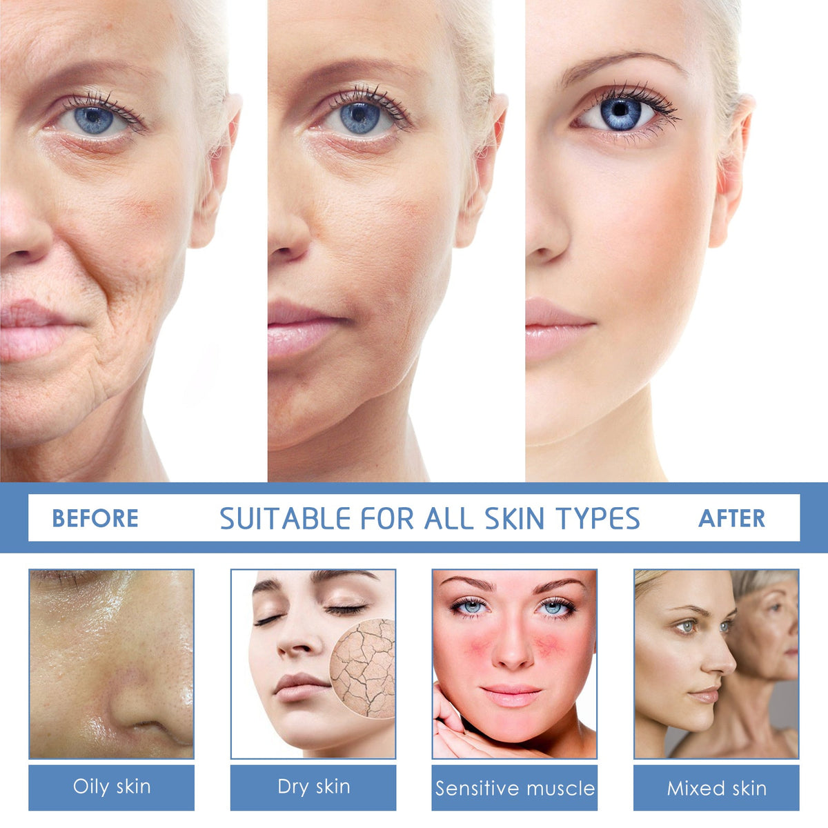Botox Stock Solution Facial Serum, Firming Light Lines Moisturizing Anti-aging Essence