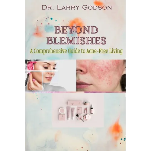 Beyond Blemishes: A Comprehensive Guide to Acne-Free Living/ Skincare Bible for Radiant Skin - Paperback