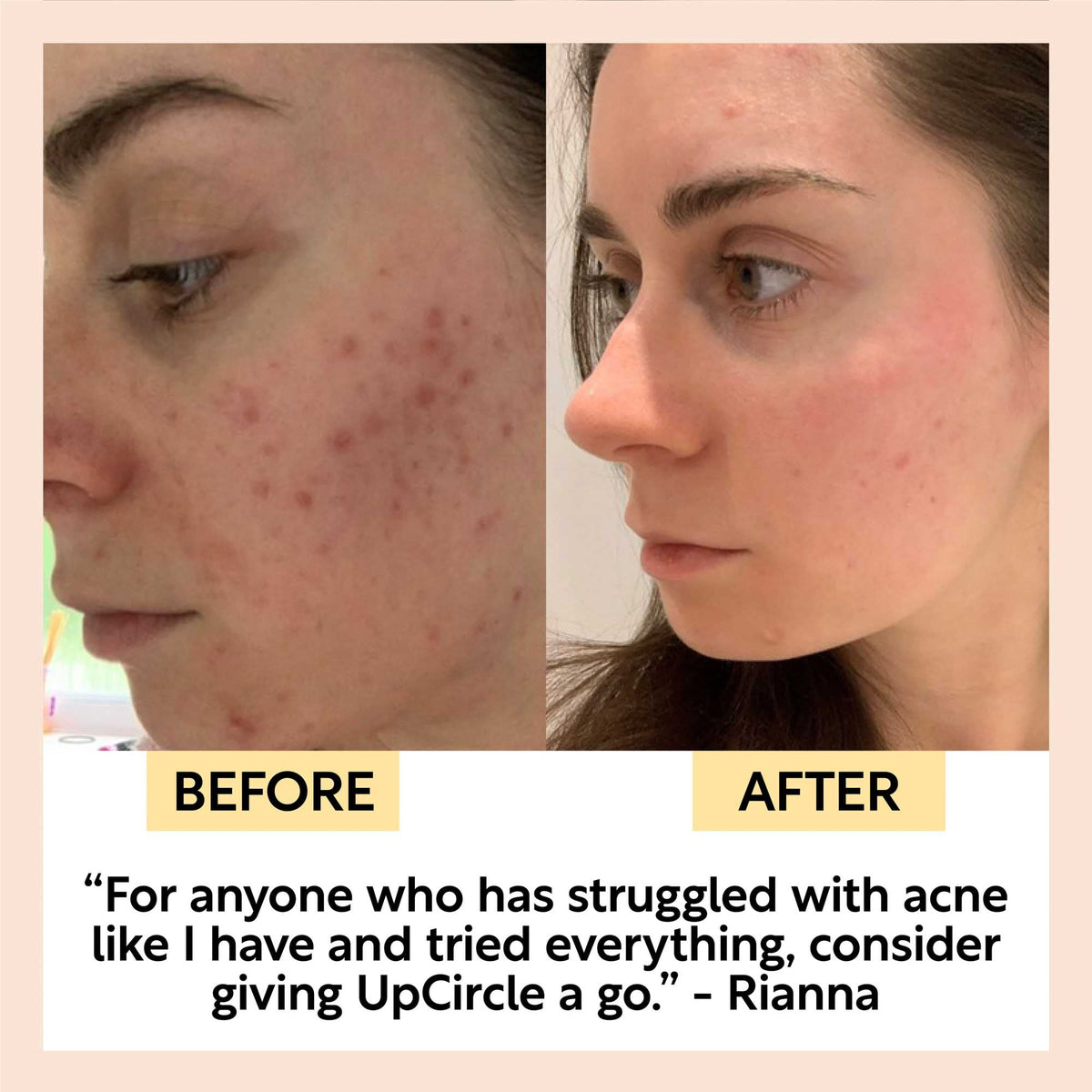 Cleanse, Tone + Moisturize Set