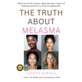 The Truth About Melasma: What You Need to Know About the Root Causes of Melasma and How to Treat It Holistically - Paperback