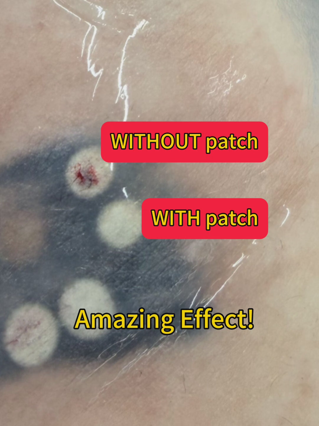 PFD Silicone Patch for Laser Tattoo Removal / 4x4" 10 Patches per Box