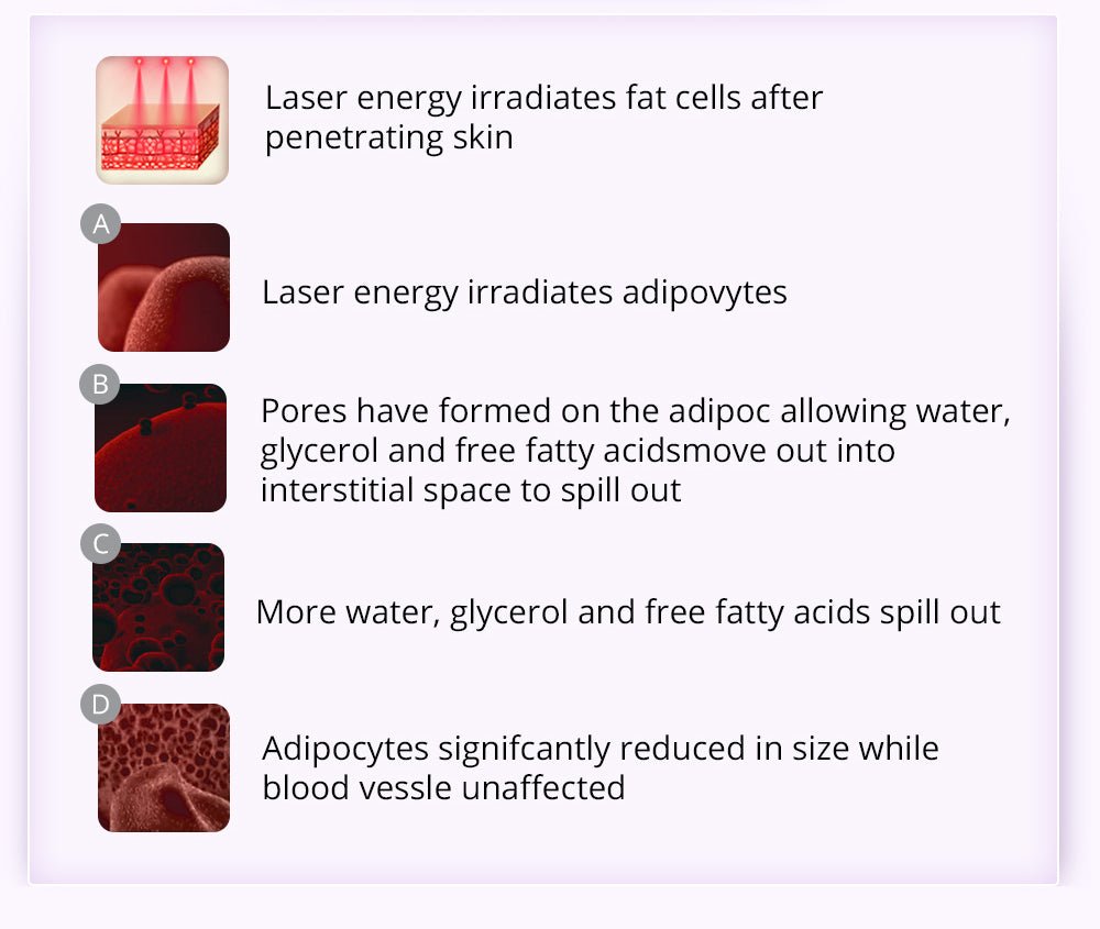 Shape Tactics 9-in-1 Lipo Microcurrent Photon Ultrasonic Cavitation System