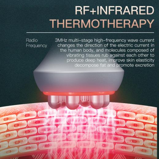 Shape Tactics ContourPro 5-in-1 80K Ultrasonic RF System