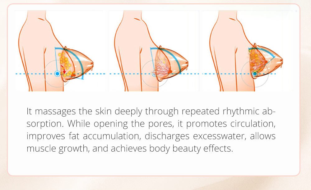 Shape Tactics EMS Vacuum Cupping Body Contouring System