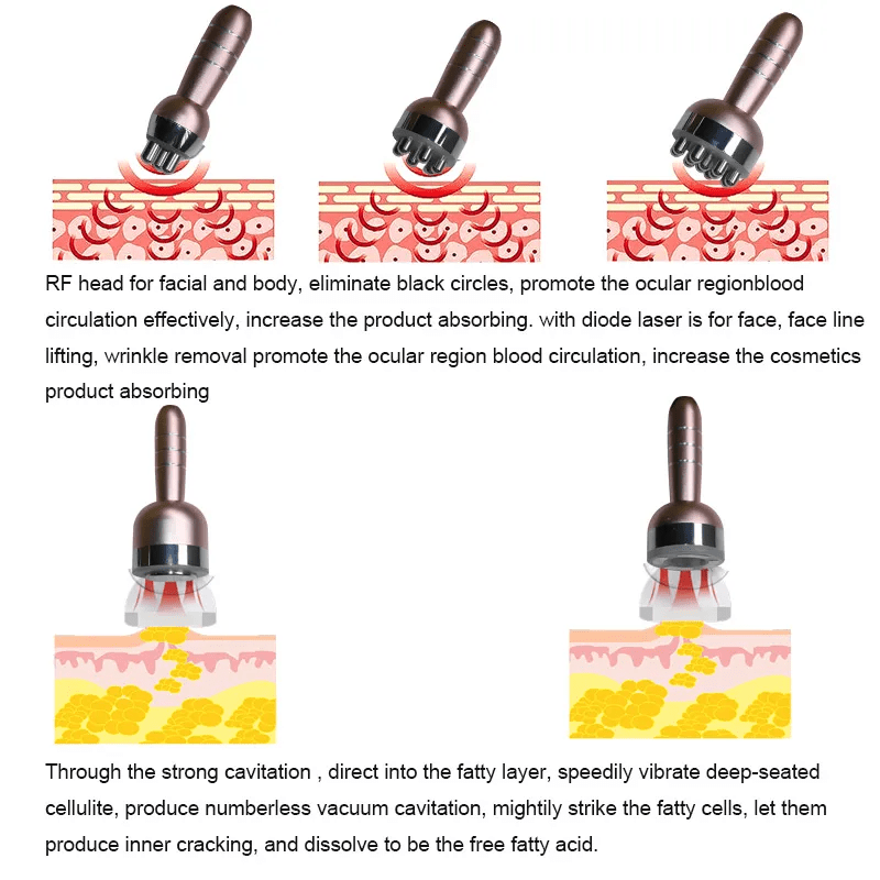 Shape Tactics ProElite 40K RF Lipo Laser System