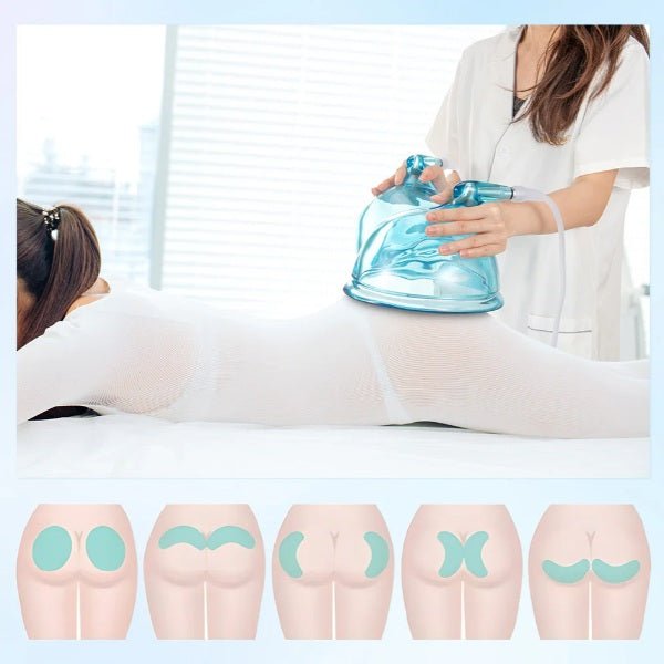Shape Tactics 21cm Vacuum BBL Suction Therapy Cups
