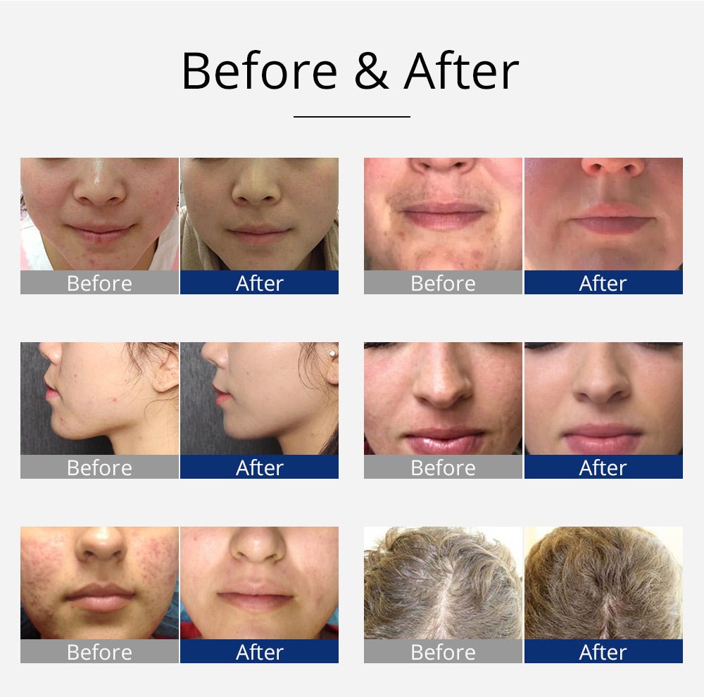 Shape Tactics Violet 7-Electrode High-Frequency Facial System